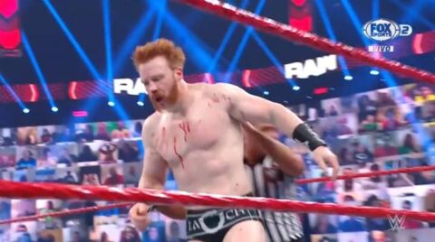 Update On Sheamus Suffering Broken Nose On WWE Raw