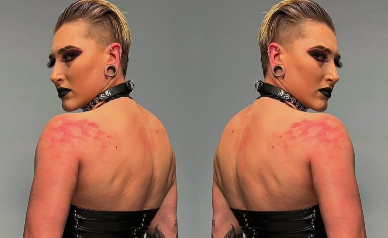 Photos: Rhea Ripley Suffered Wardrobe Malfunction On WWE Raw; Showed