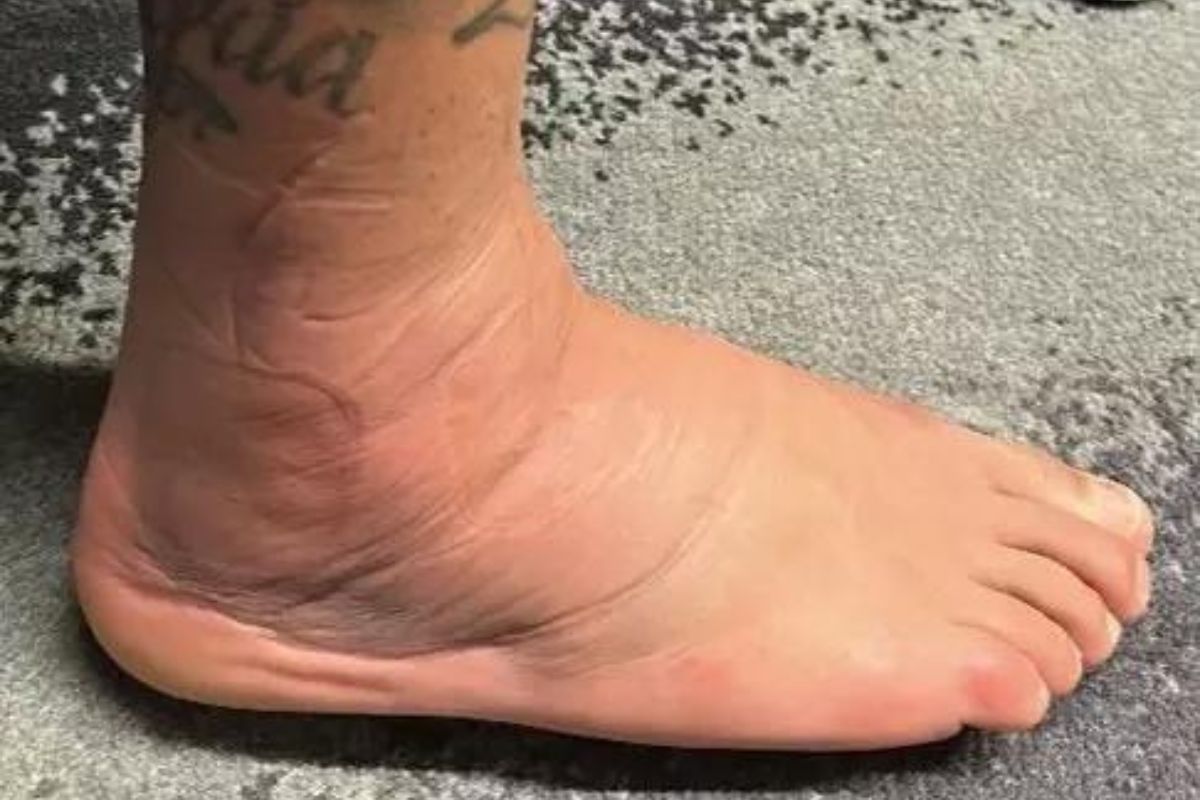 Brazil'S Neymar Nightmare Could Get Worse As Psg Star Faces Possibility Of Being Ruled Out Of The Remainder Of World Cup Due To Ankle Injury 3 Neymar