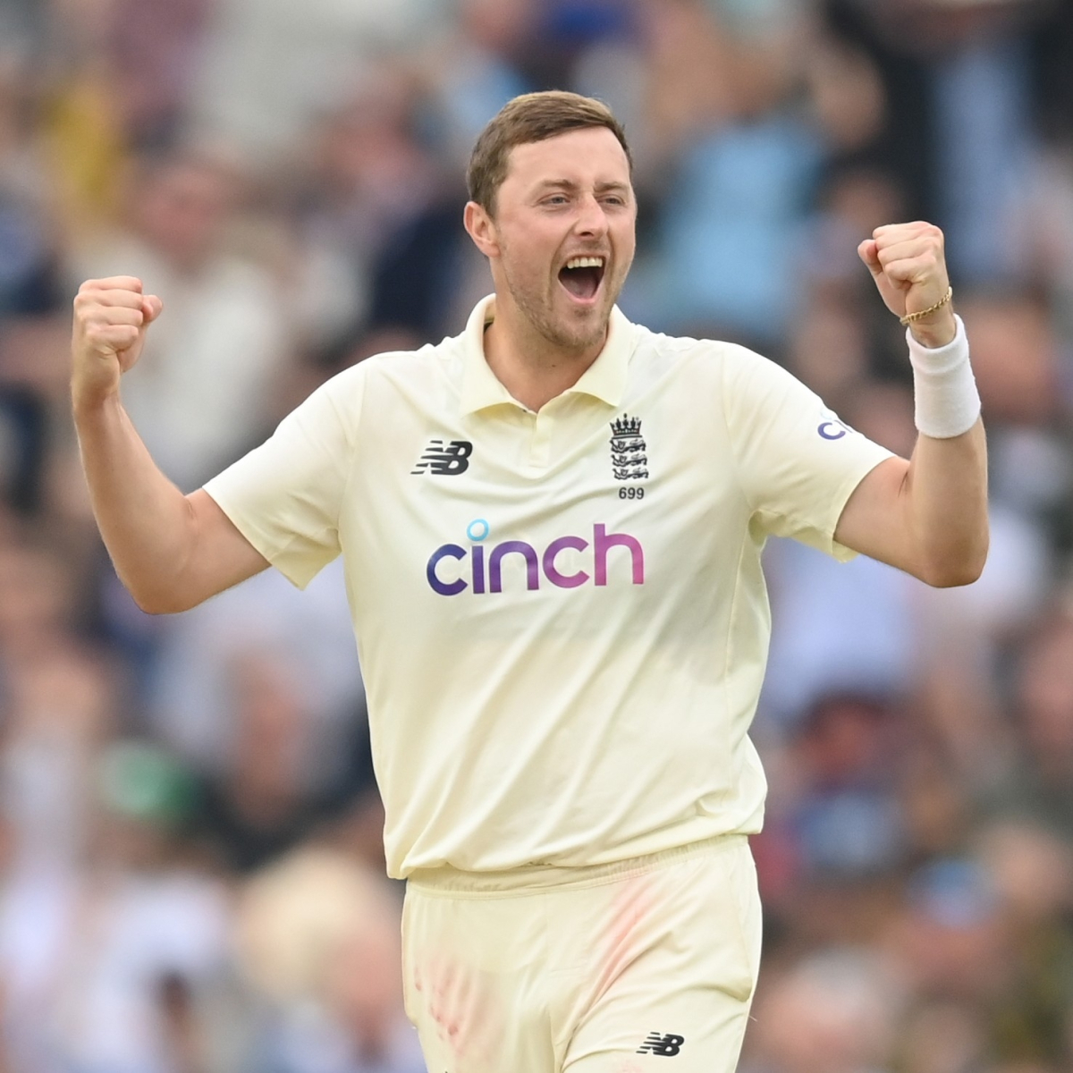 England Provides Ollie Robinson Injury Update After Ankle Scan 2